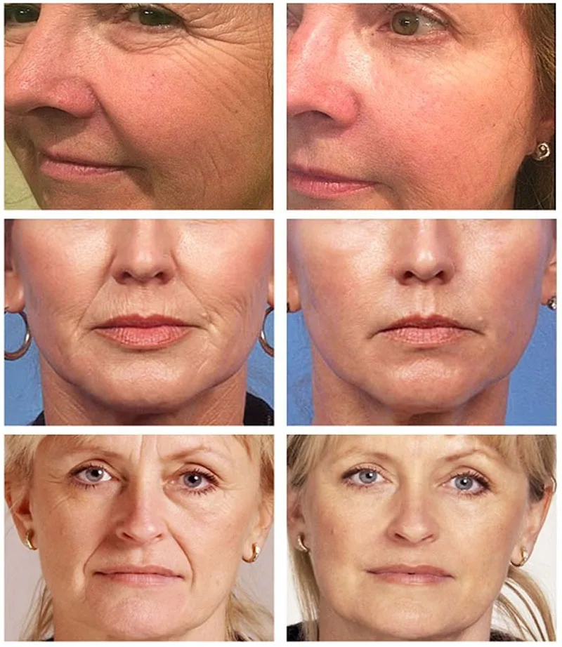 Serum do twarzy z kolagenem re – Vitamin C Serum Face recenzja i cena